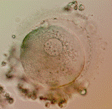 1PN SCNT thumbnail image