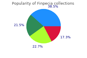 order 1mg finpecia with amex