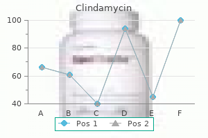 order clindamycin 150 mg free shipping