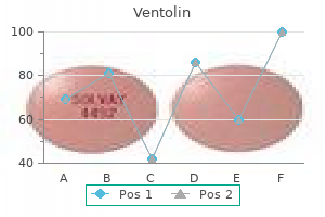 purchase ventolin 100mcg on line